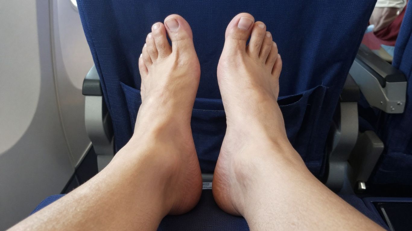 Person's swollen feet on an airplane seat.