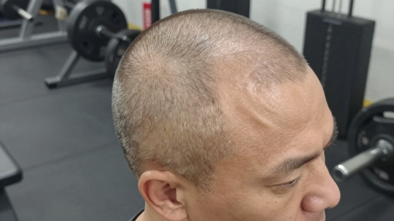 Person exercising, hair thinning concerns