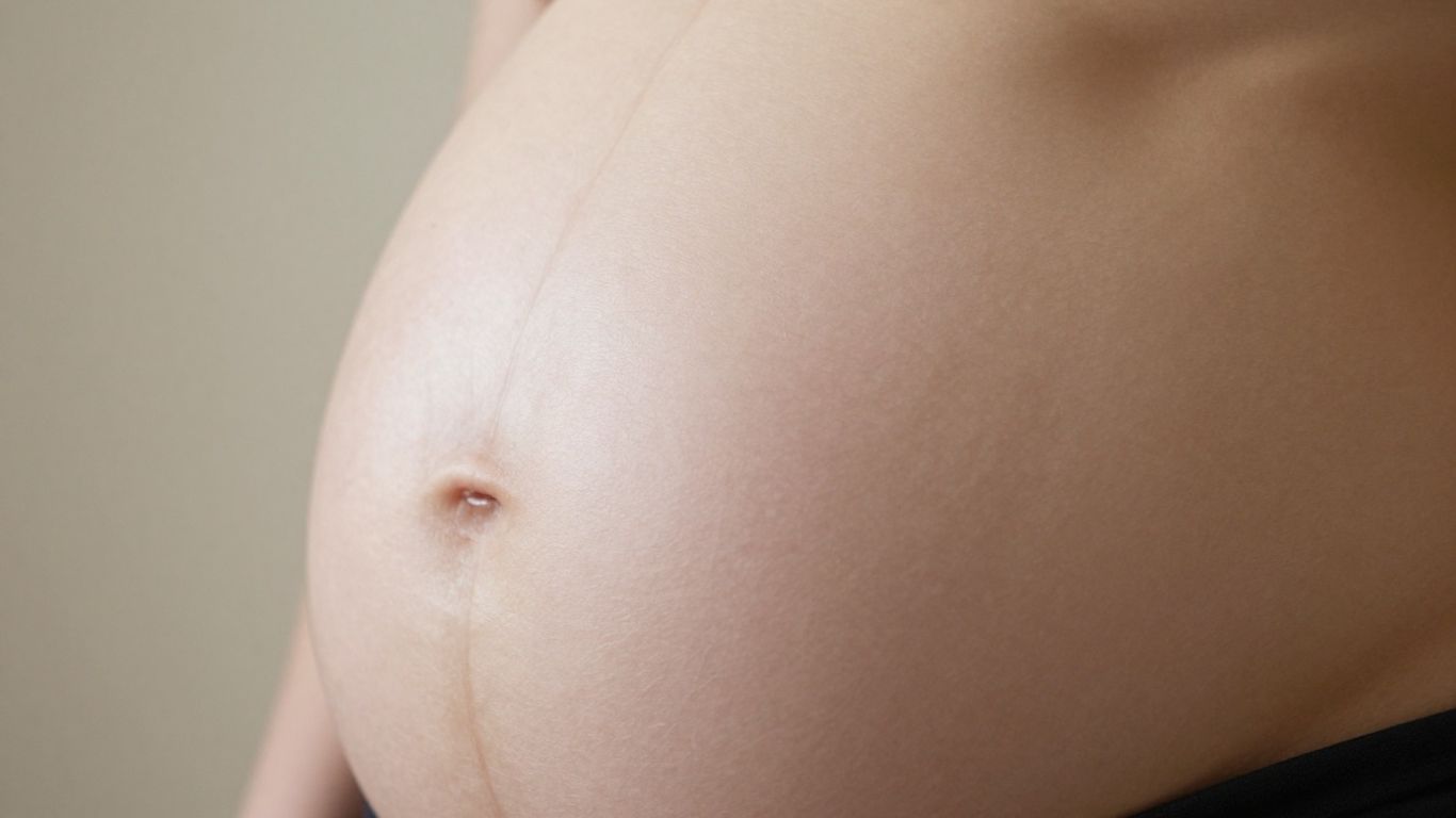 Línea alba en el abdomen de una mujer embarazada.