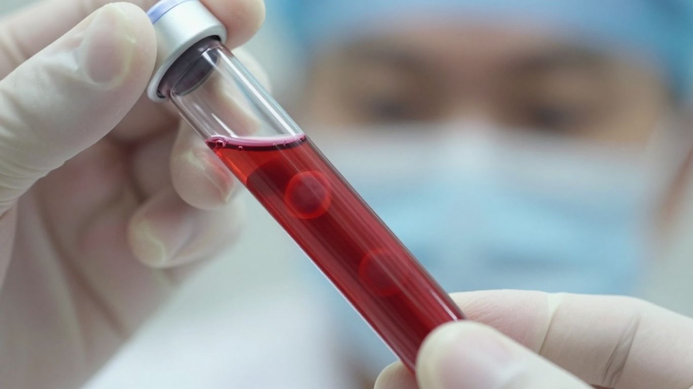 Blood sample vial held by a medical professional.