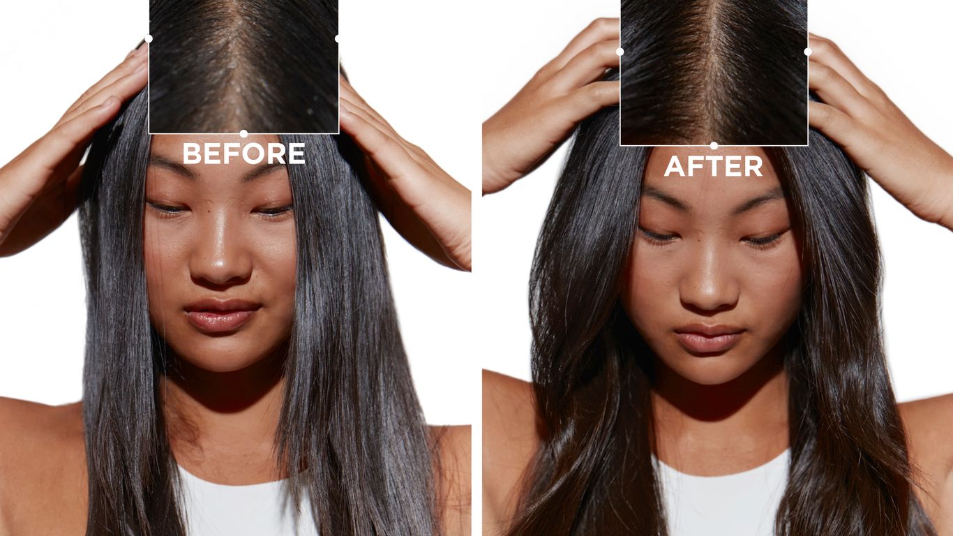 Before and after comparison of hair treatment results on a person.