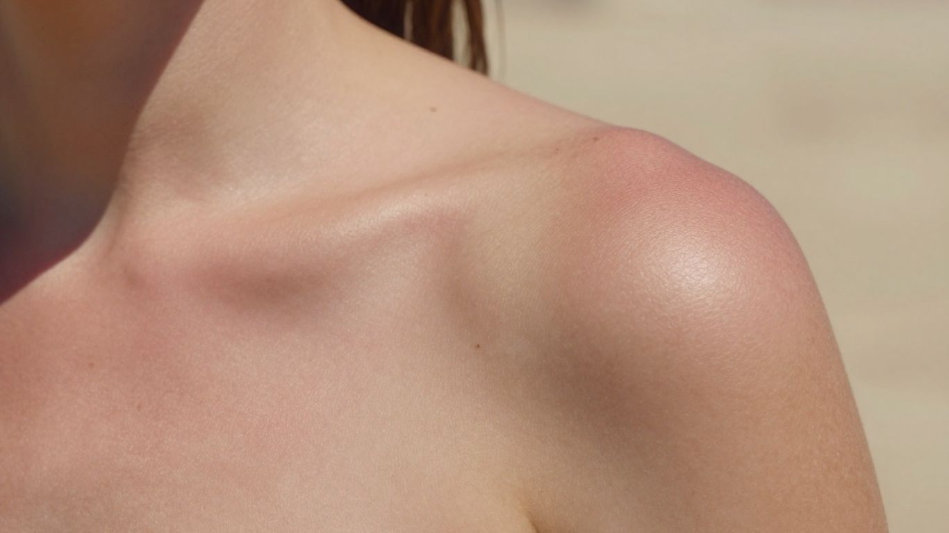 Sonnengereifte Haut mit leichten Rötungen und Sommersprossen.