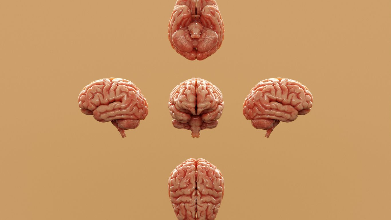 Various perspectives of a human brain are displayed.