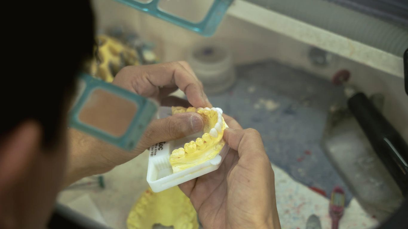 Hands working on a dental mold with artificial teeth.