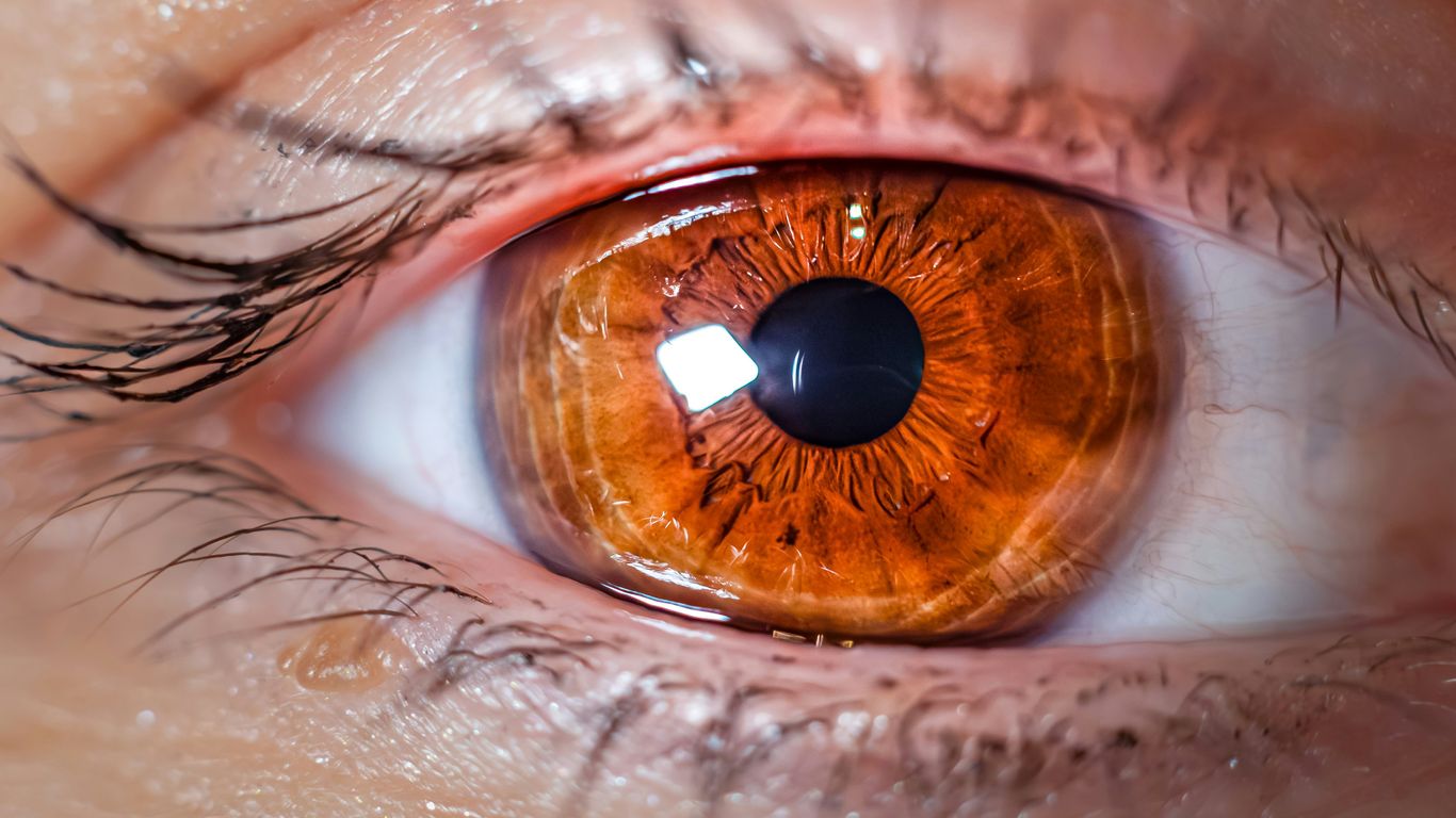 A close up of a person's eye with an orange iris