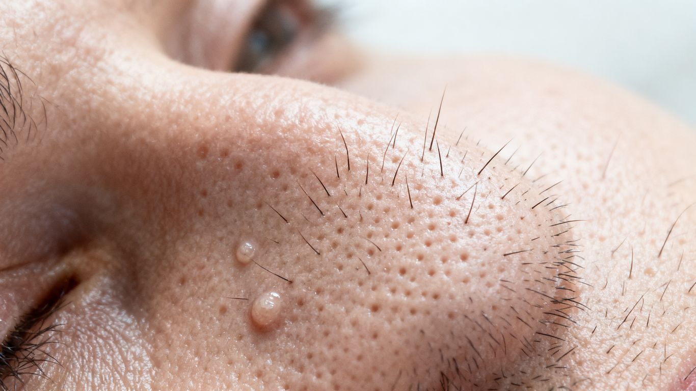 A close up view of facial hair follicles