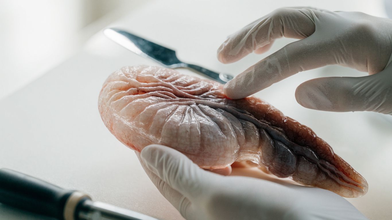 Type 2 diabetes vs. type 1: Key differences in causes, symptoms, and treatment 3 Immune cells near insulin-producing pancreatic cells