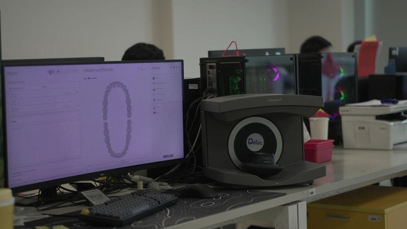 Dental scanner and computer displaying tooth models in an office.