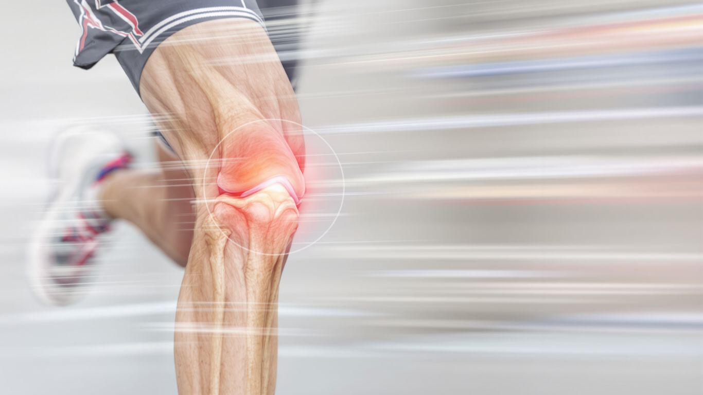Rodilla de corredor con posible lesión de ligamento