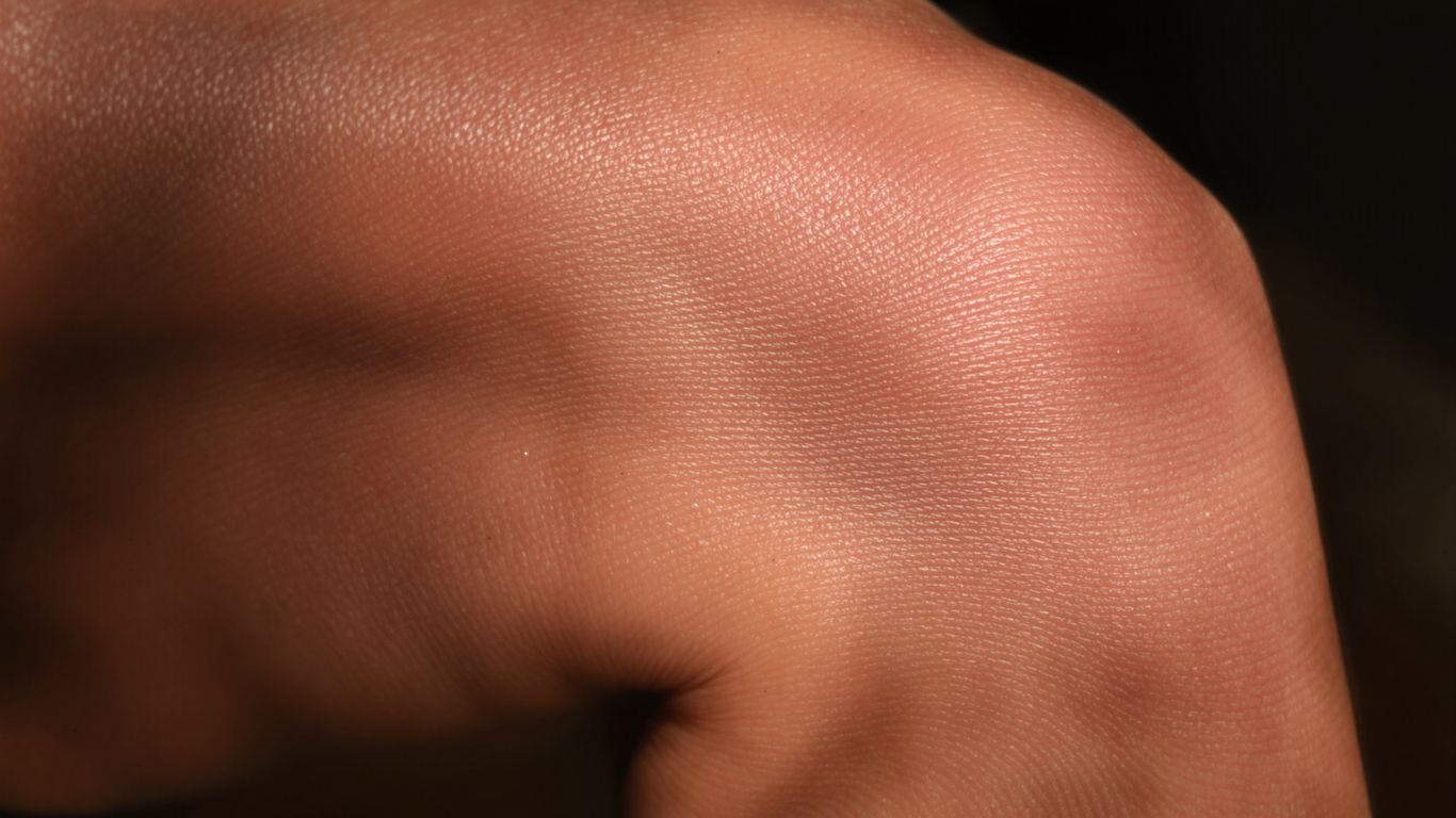 Rodilla con implante metálico brillante y natural.