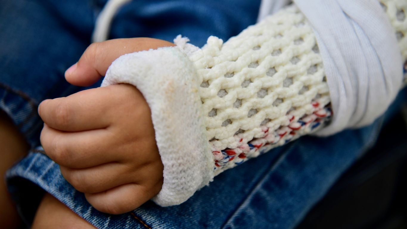 Child's arm in a knitted cast and sling.