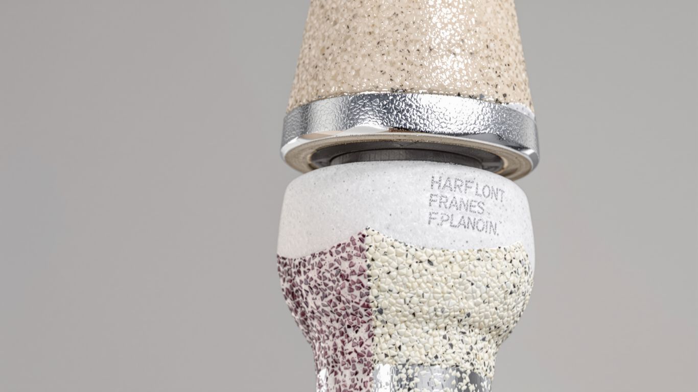 Implante de cadera con componentes de metal y cerámica.