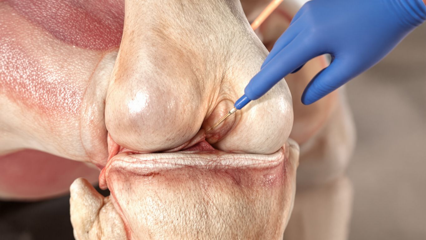 Rodilla sana con cartílago visible.