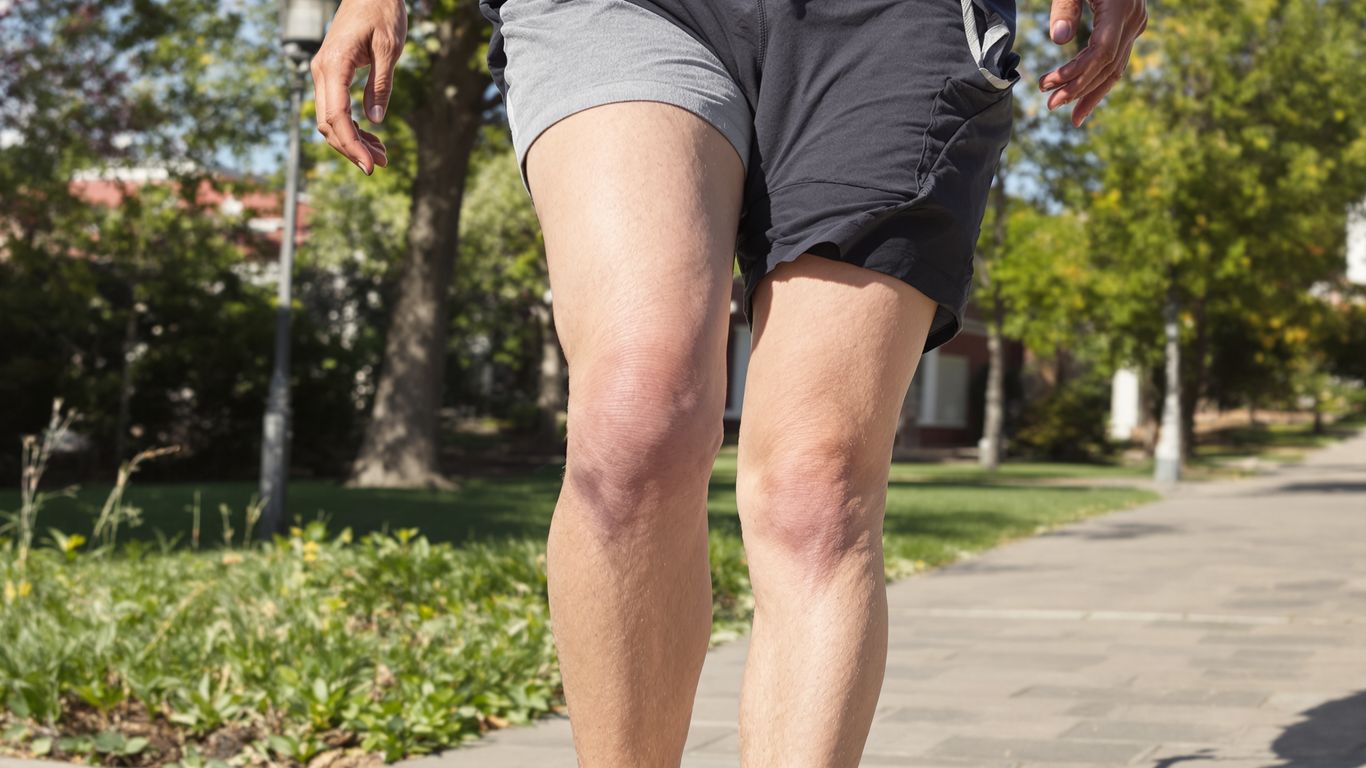 Persona caminando con prótesis de cadera o rodilla.