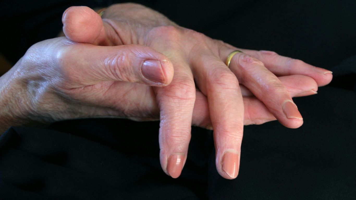 a close up of a person's hands holding another person's hand