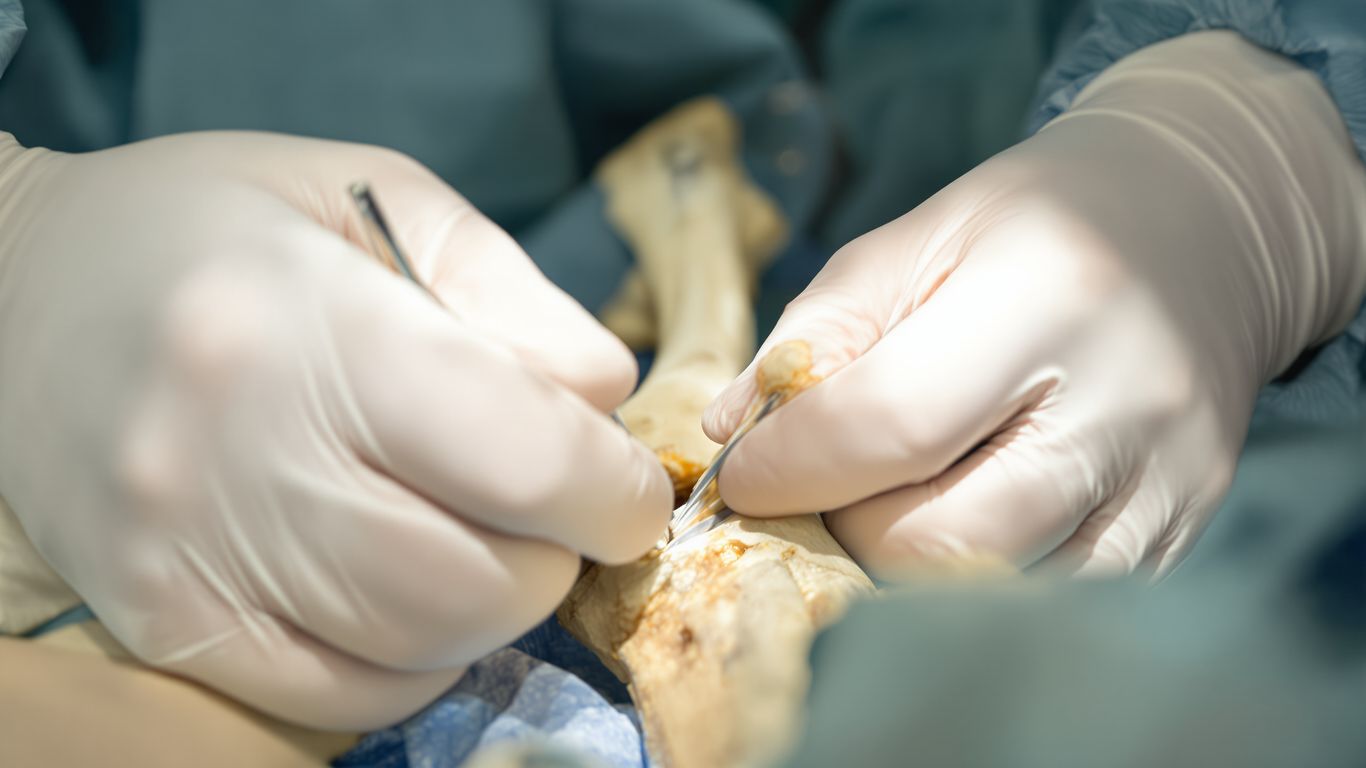 Manos cirujano ortopédico instrumentos hueso operación