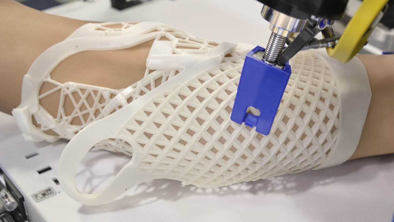Prótesis ortopédica impresa en 3D personalizada.