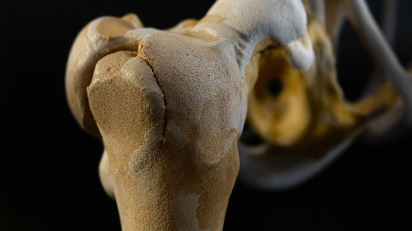 Articulación de cadera con efectos de tiempo sutiles.