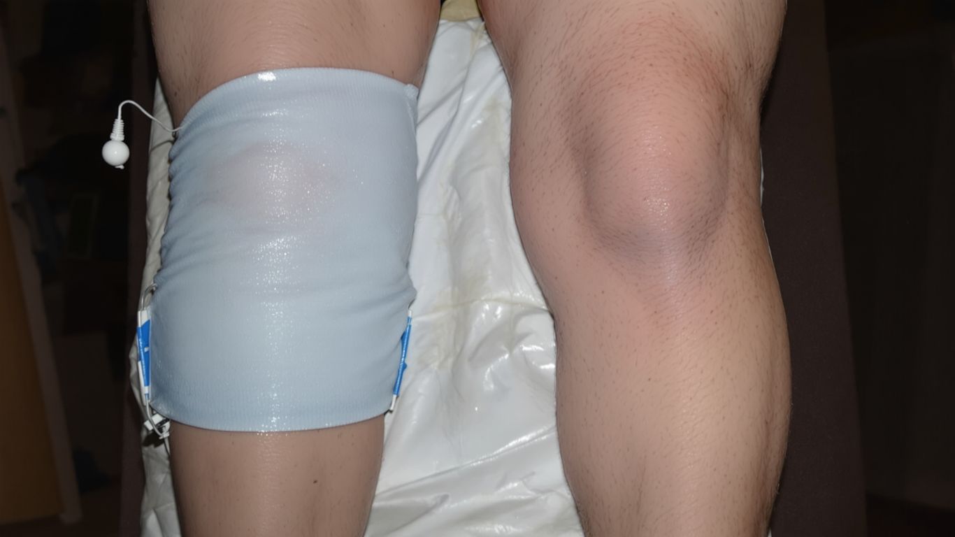 Piernas después de un reemplazo de rodilla.
