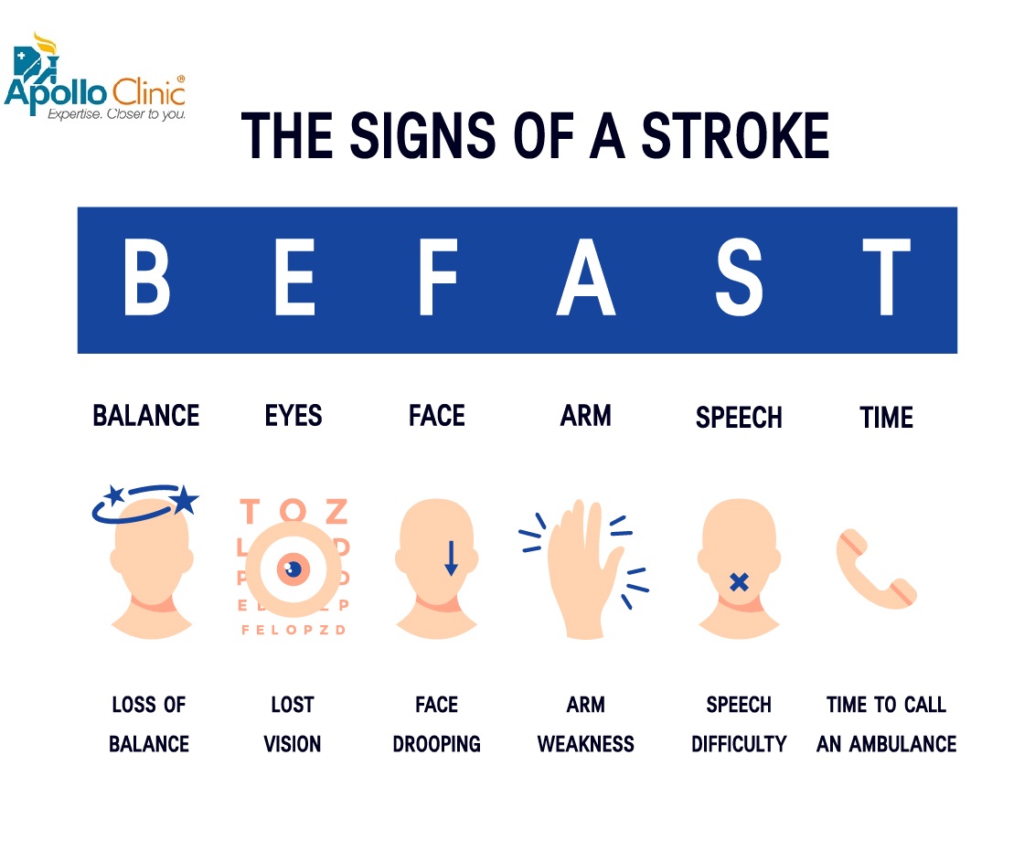 The Sign of a Stroke