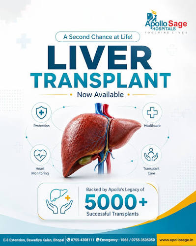 Liver transplant