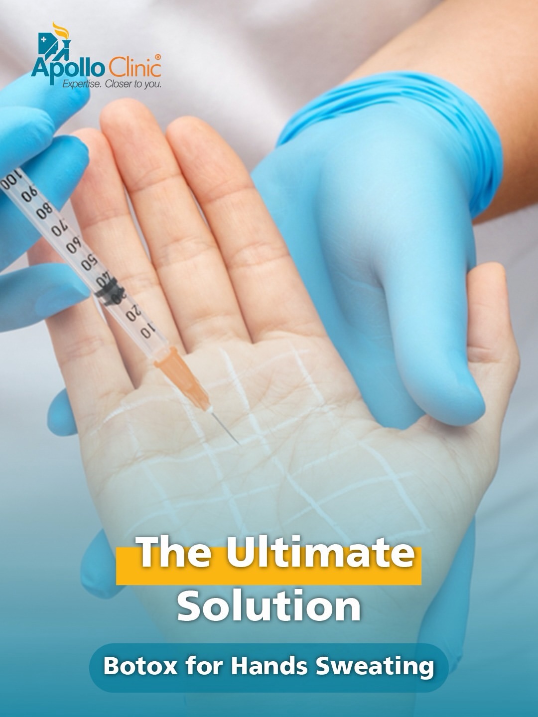 Botox for Hand Sweating 