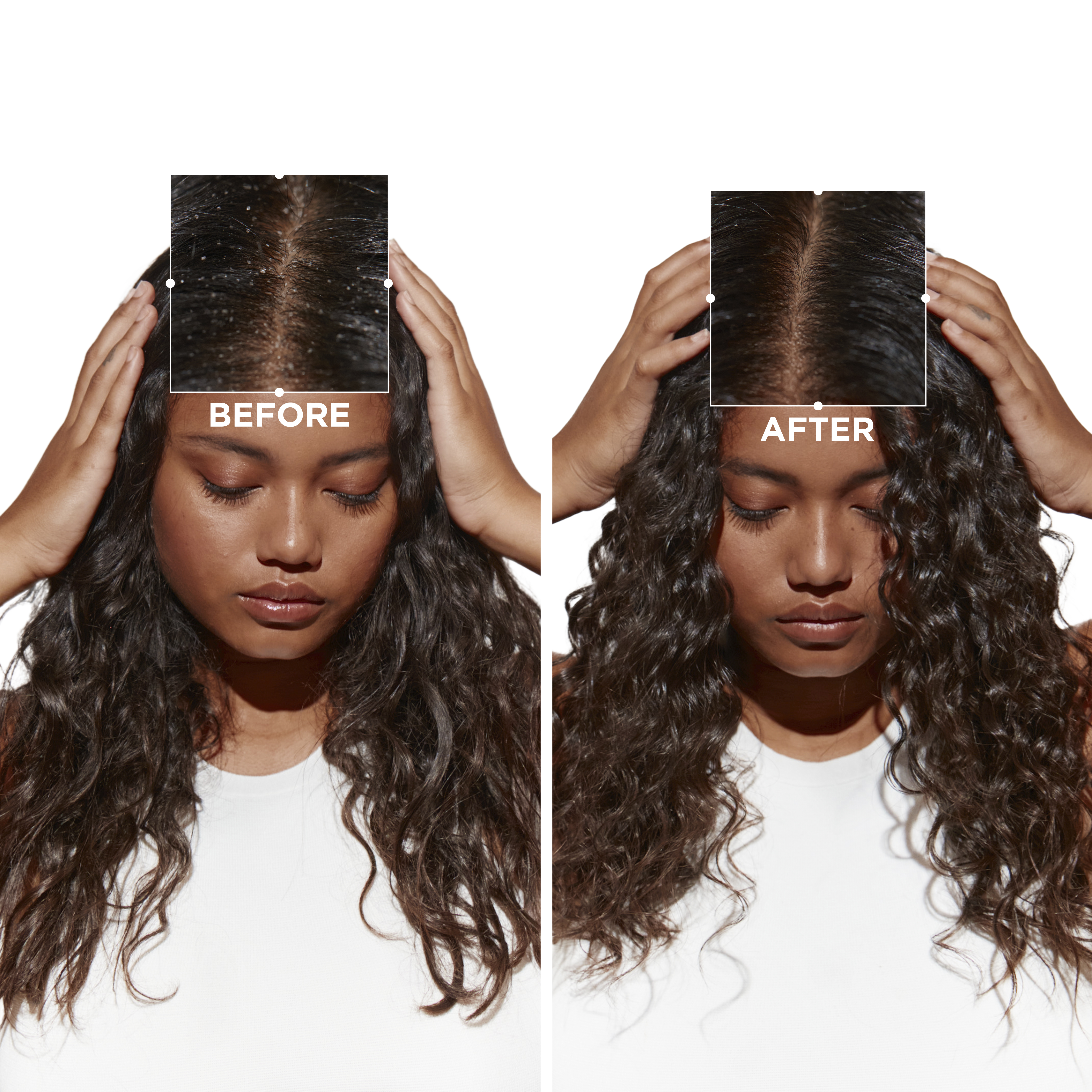 Damaged hair serum beside styling tools